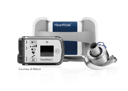 LVAD Option 1