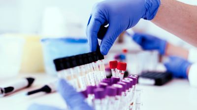 Doctor grabs test tubes