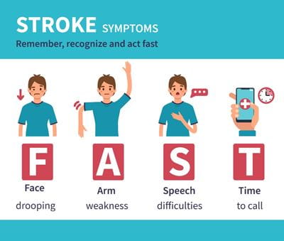 FAST acronym  Face Arm Speech Time