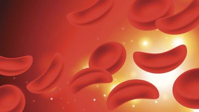 Sickle cells