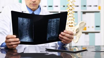 Spine surgeon looks at X-rays