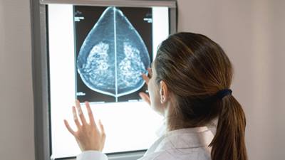 Doctor examining breast x-ray