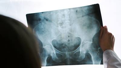 female doctor examining pelvis x-ray