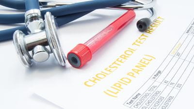 Image of cholesterol test results