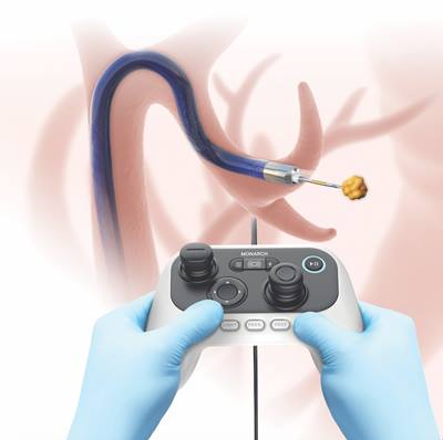 Monarch remote controlling lung procedure