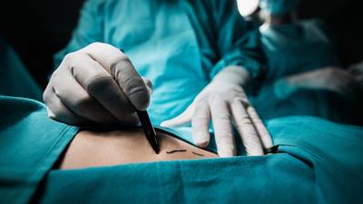 Surgeon marking patients stomach