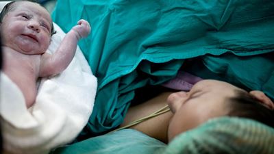 Woman having C-section