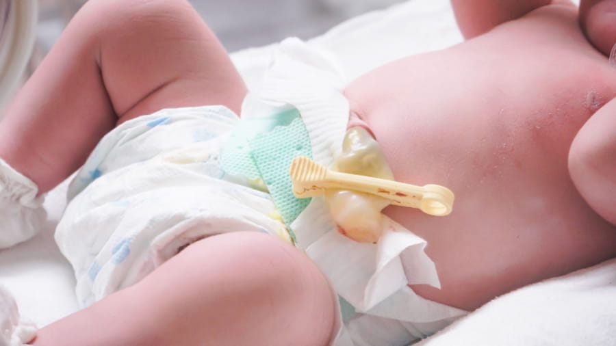Umbilical cord on baby