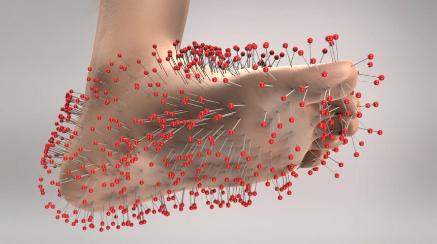 Understanding Peripheral Neuropathy