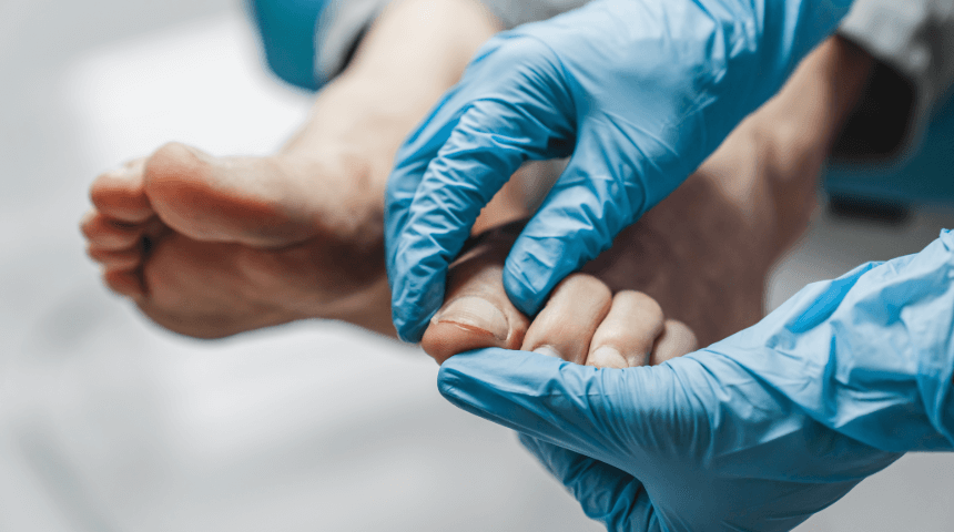 A Fungus Among Us: Why You Should Take Care of Your Toenails