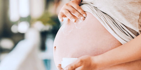 Can I Avoid Getting Stretch Marks?