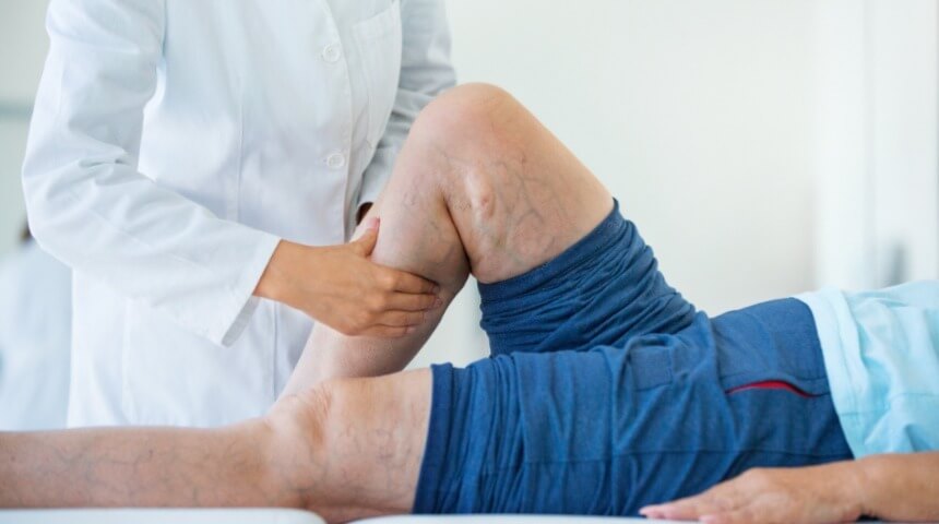How To Treat Your Varicose Veins