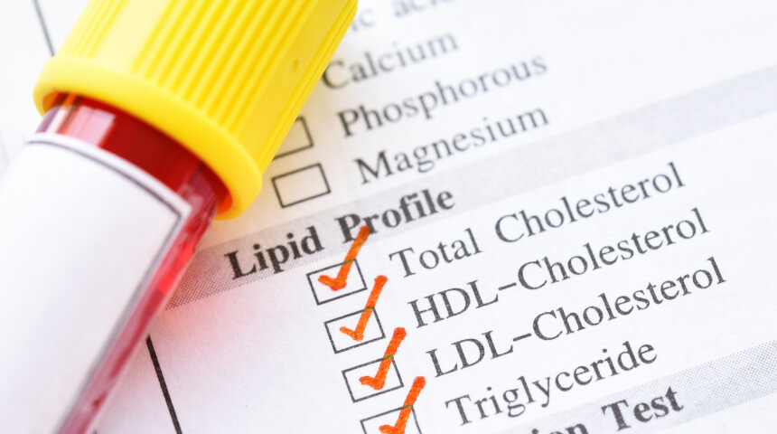 Cholesterol Checkups: Why Regular Monitoring Is Essential for Heart Health
