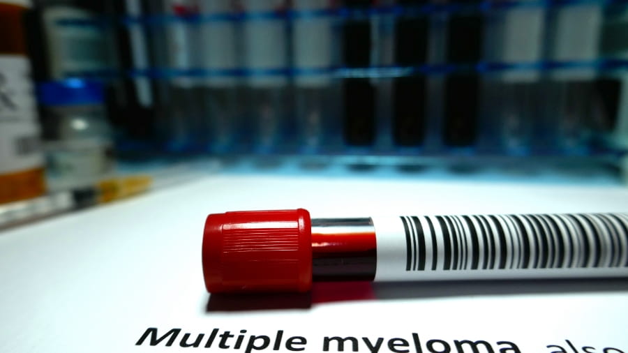 A sample of blood being tested for myeloma