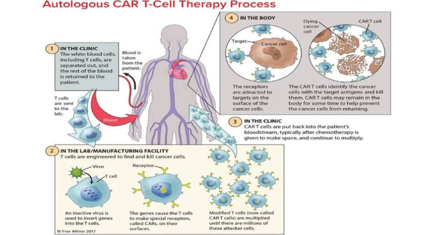 CAR T-Cell Therapy Reengineers Immune Cells To Fight Cancer