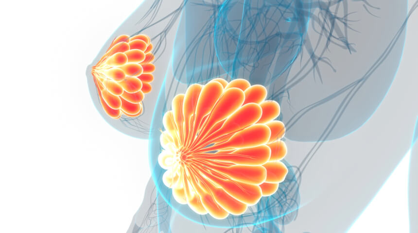 Advanced Techniques Used in Tandem Microsurgery Return Sensation to Nipples Post-Mastectomy