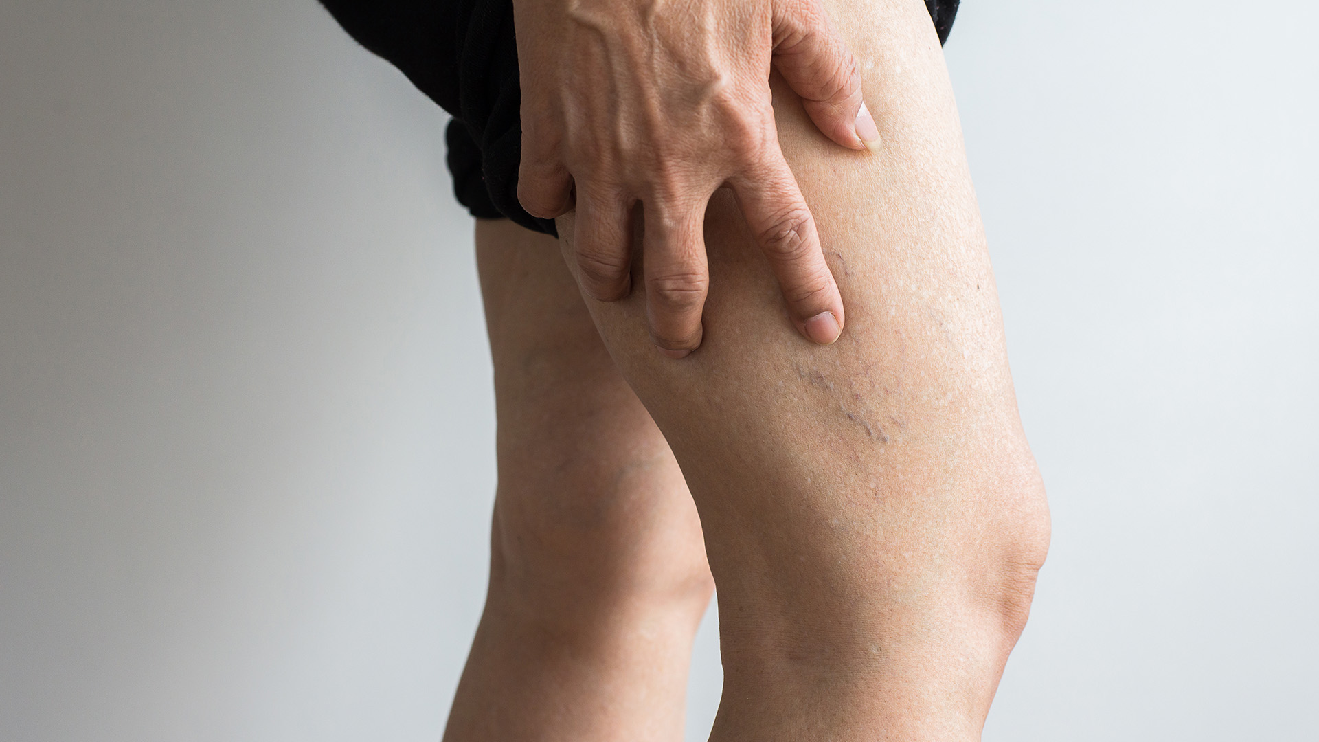 5978-844998 Signs and Symptoms of Blood Clots__header
