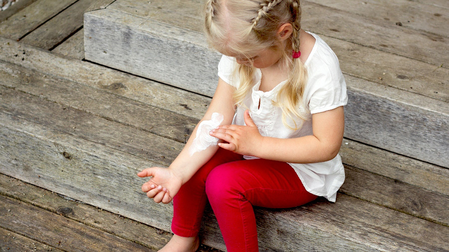 Little girl putting ointment on arm