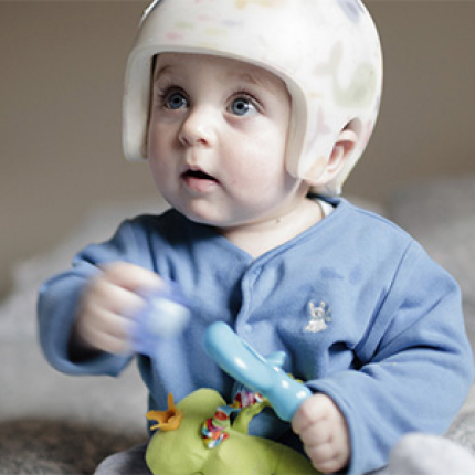 Pediatric Plagiocephaly Program