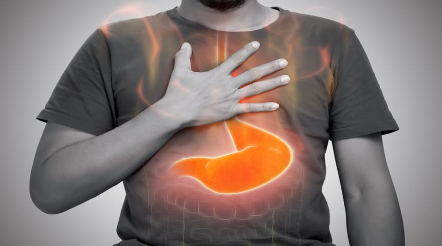 Barrett’s Esophagus: A Hidden Risk for Esophageal Cancer
