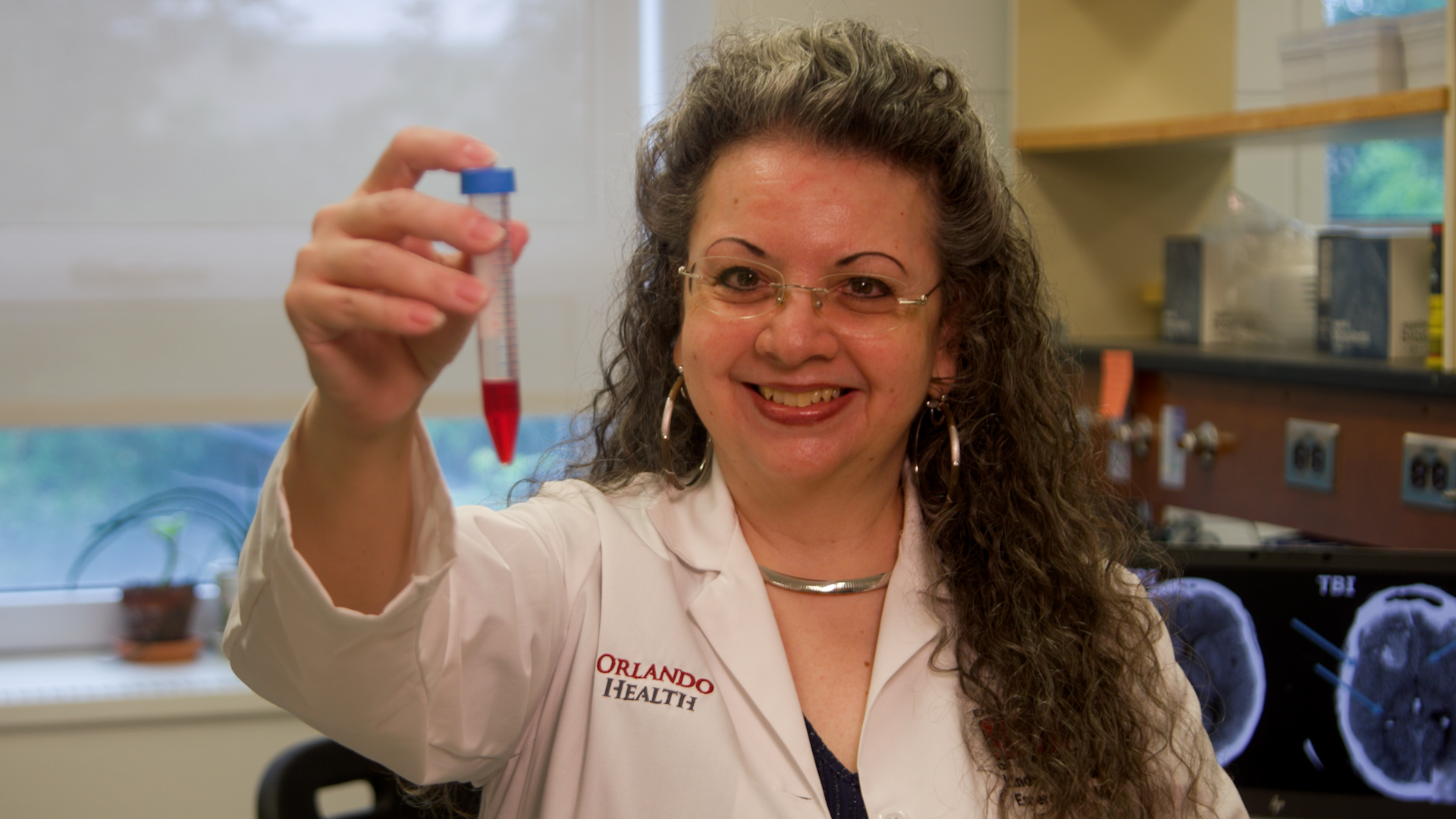 Orlando Health First in the World to Use Abbotts New Blood Test for Traumatic Brain Injuries