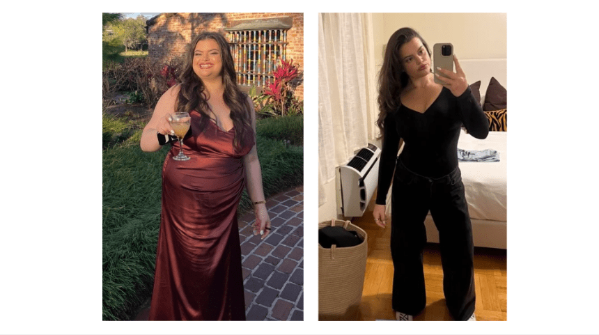 After Diets and GLPs Fail, Woman Drops 60 Pounds with Less-Invasive Endoscopic Procedure