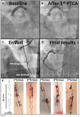 Envast Figure 1