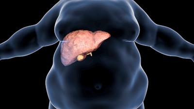 Overweight person with fatty liver disease