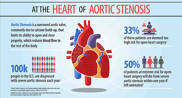 Heart Statistics